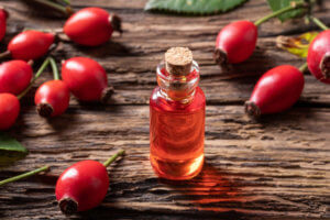 top health benefits of rosehips