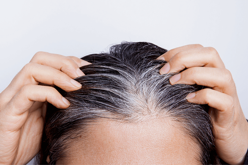 Prevent Hair Loss