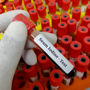 Iodine test